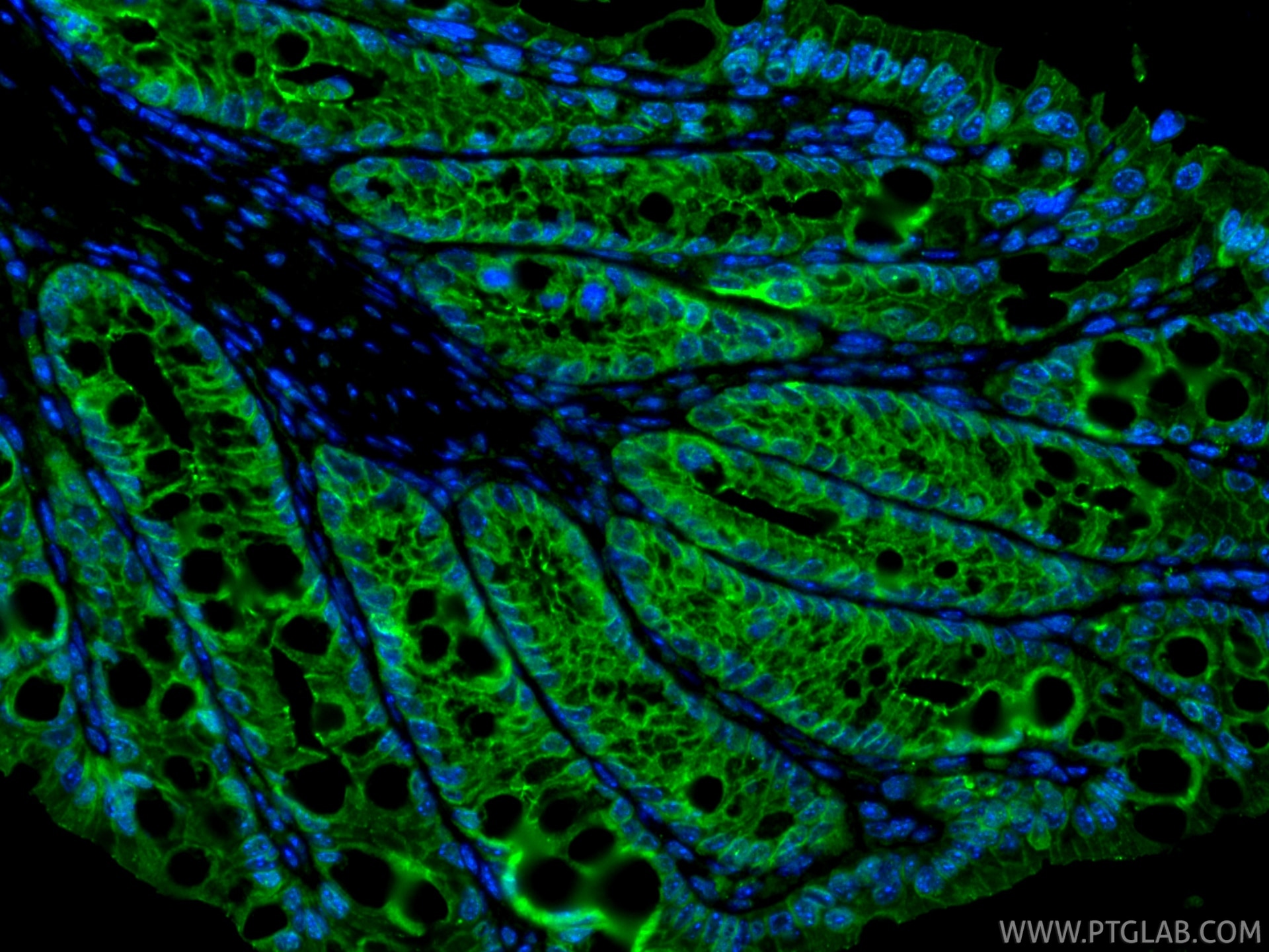 IF Staining of mouse colon using 13409-1-AP Immunofluorescence (IF) / fluorescent staining of mouse colon tissue using Occludin Polyclonal antibody (13409-1-AP)