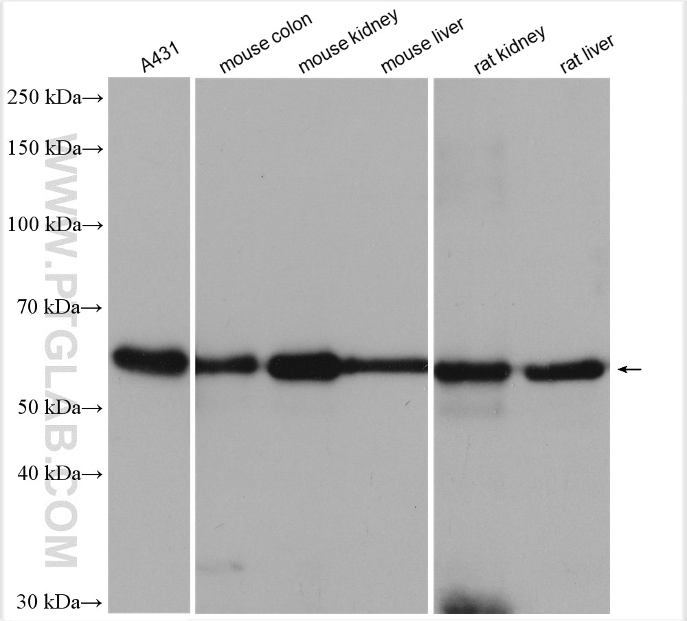 Western Blot (WB) analysis of various lysates using Occludin Polyclonal antibody (13409-1-AP)