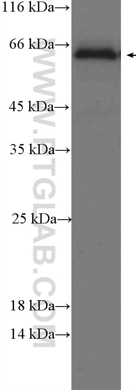 Western Blot (WB) analysis of mouse liver tissue using Occludin Polyclonal antibody (13409-1-AP)