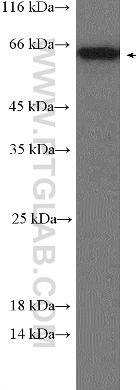 Western Blot (WB) analysis of mouse liver tissue using Occludin Polyclonal antibody (13409-1-AP)