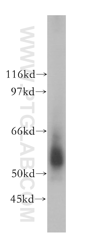 WB analysis of human kidney using 13409-1-AP