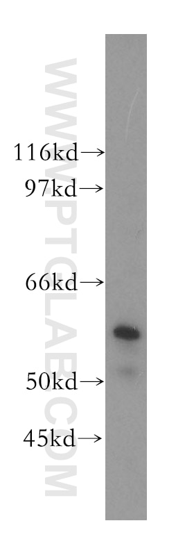 Western Blot (WB) analysis of human liver tissue using Occludin Polyclonal antibody (13409-1-AP)