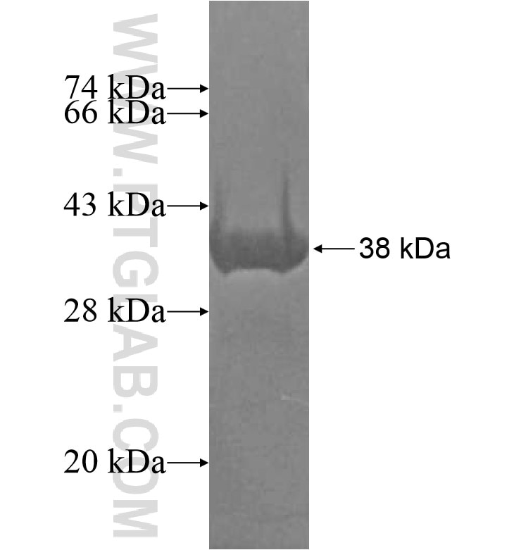 OCM fusion protein Ag16358 SDS-PAGE