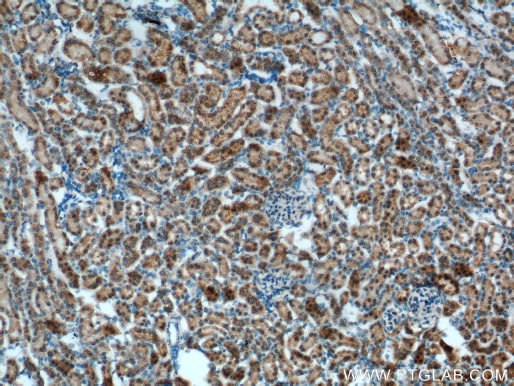 IHC staining of mouse kidney using 17695-1-AP