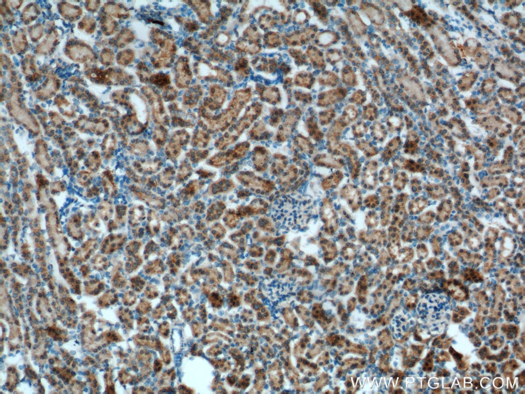 Immunohistochemistry (IHC) staining of mouse kidney tissue using OCRL Polyclonal antibody (17695-1-AP)