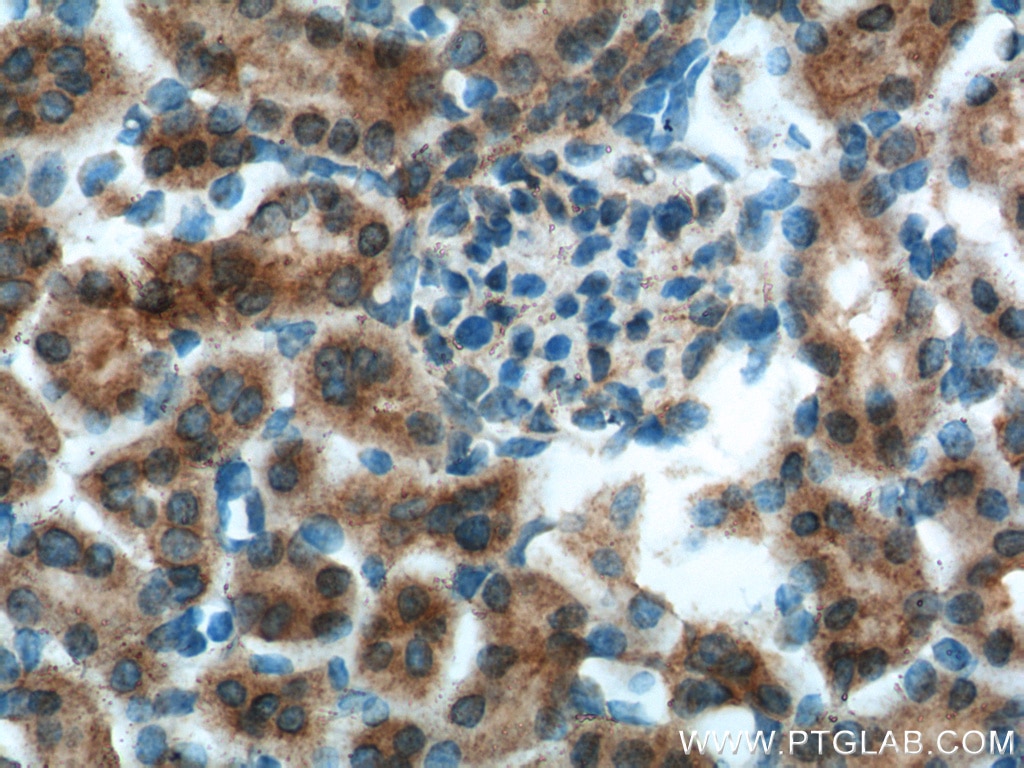 Immunohistochemistry (IHC) staining of mouse kidney tissue using OCRL Polyclonal antibody (17695-1-AP)