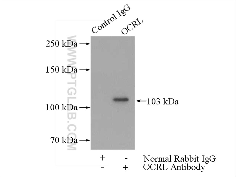 Immunoprecipitation (IP) experiment of HeLa cells using OCRL Polyclonal antibody (17695-1-AP)