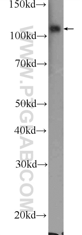 Western Blot (WB) analysis of mouse brain tissue using OCRL Polyclonal antibody (17695-1-AP)