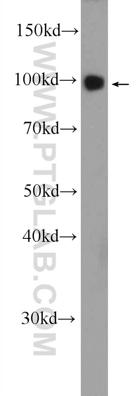 WB analysis of rat brain using 17695-1-AP