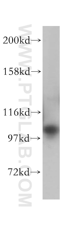 Western Blot (WB) analysis of HeLa cells using OCRL Polyclonal antibody (17695-1-AP)