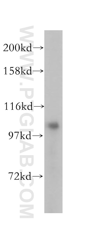 Western Blot (WB) analysis of HEK-293 cells using OCRL Polyclonal antibody (17695-1-AP)