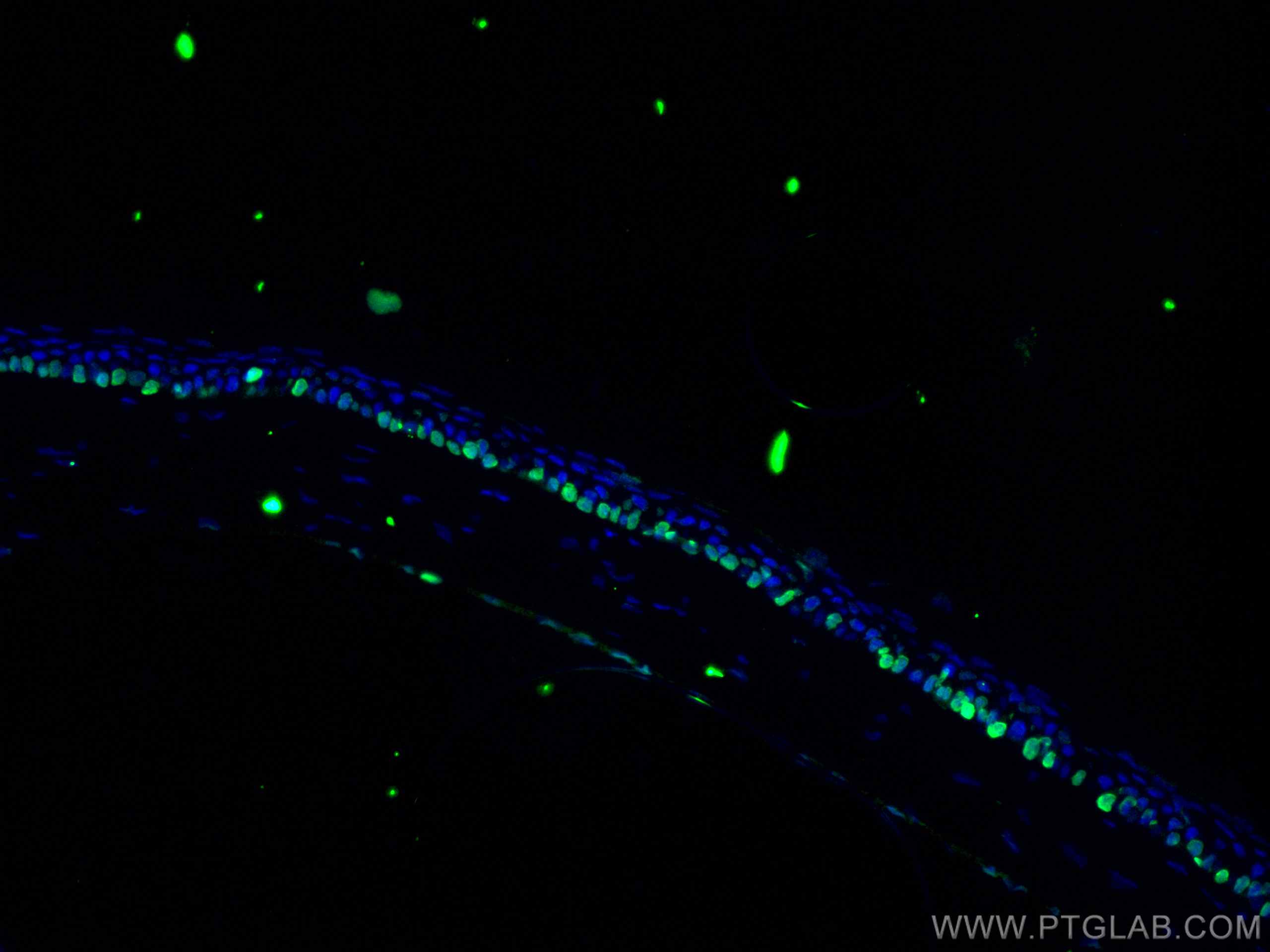 Immunofluorescence (IF) / fluorescent staining of mouse eye tissue using OCT4/POU5F1 Polyclonal antibody (11263-1-AP)