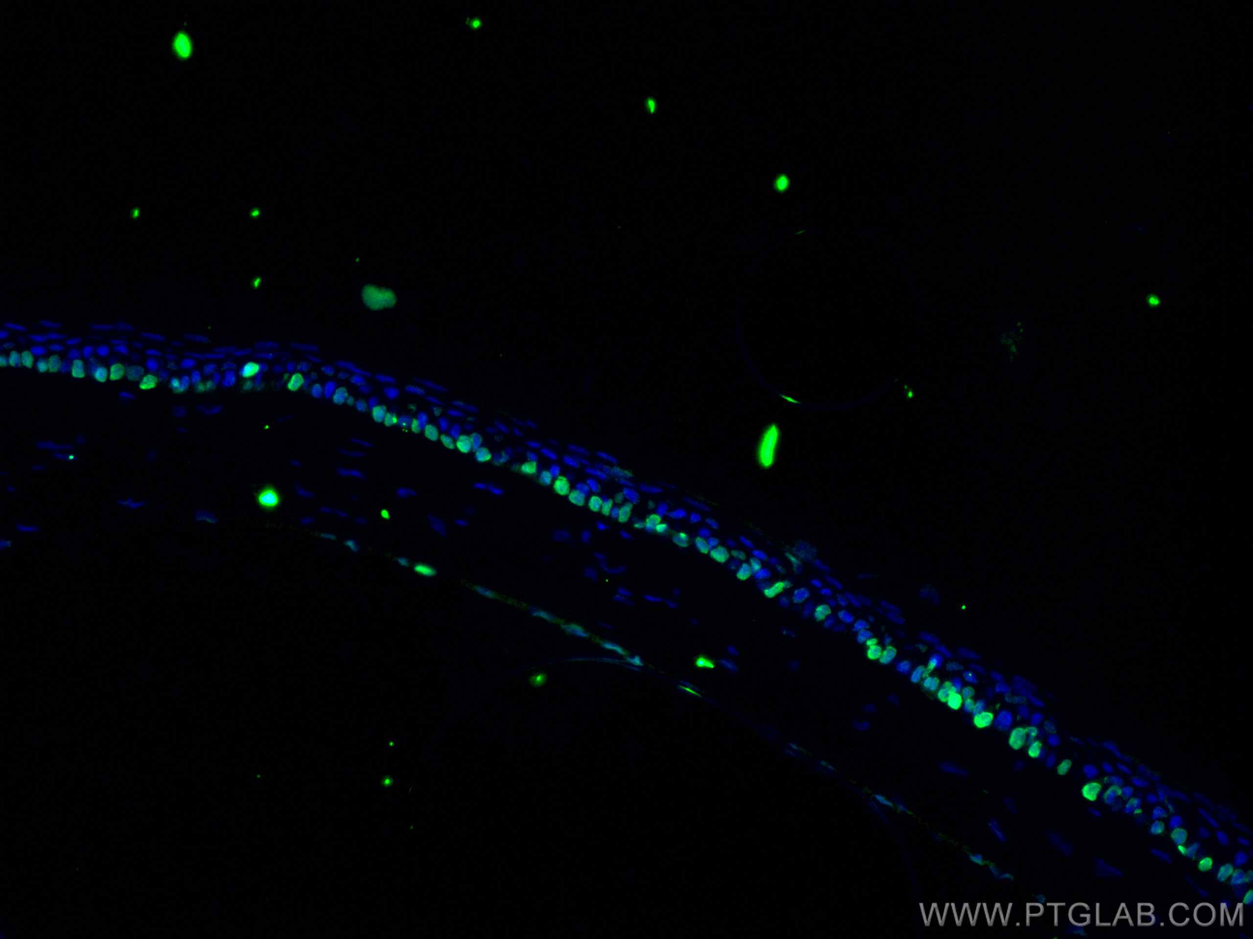 Anti-Brn-2 (POU3F2) Antibody, clone 8C4.2 clone 8C4.2, from mouse