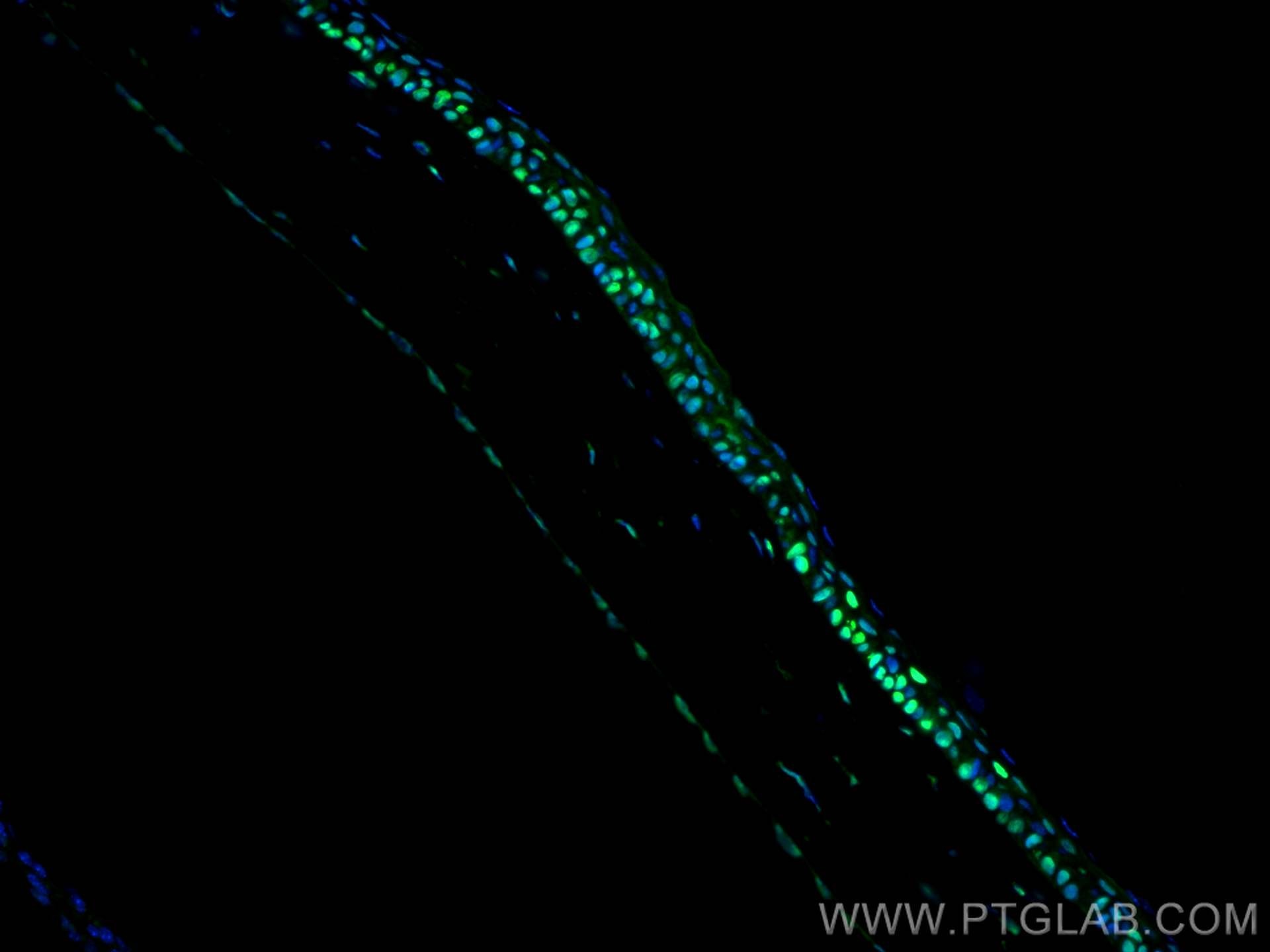 Immunofluorescence (IF) / fluorescent staining of mouse eye tissue using OCT4/POU5F1 Polyclonal antibody (11263-1-AP)