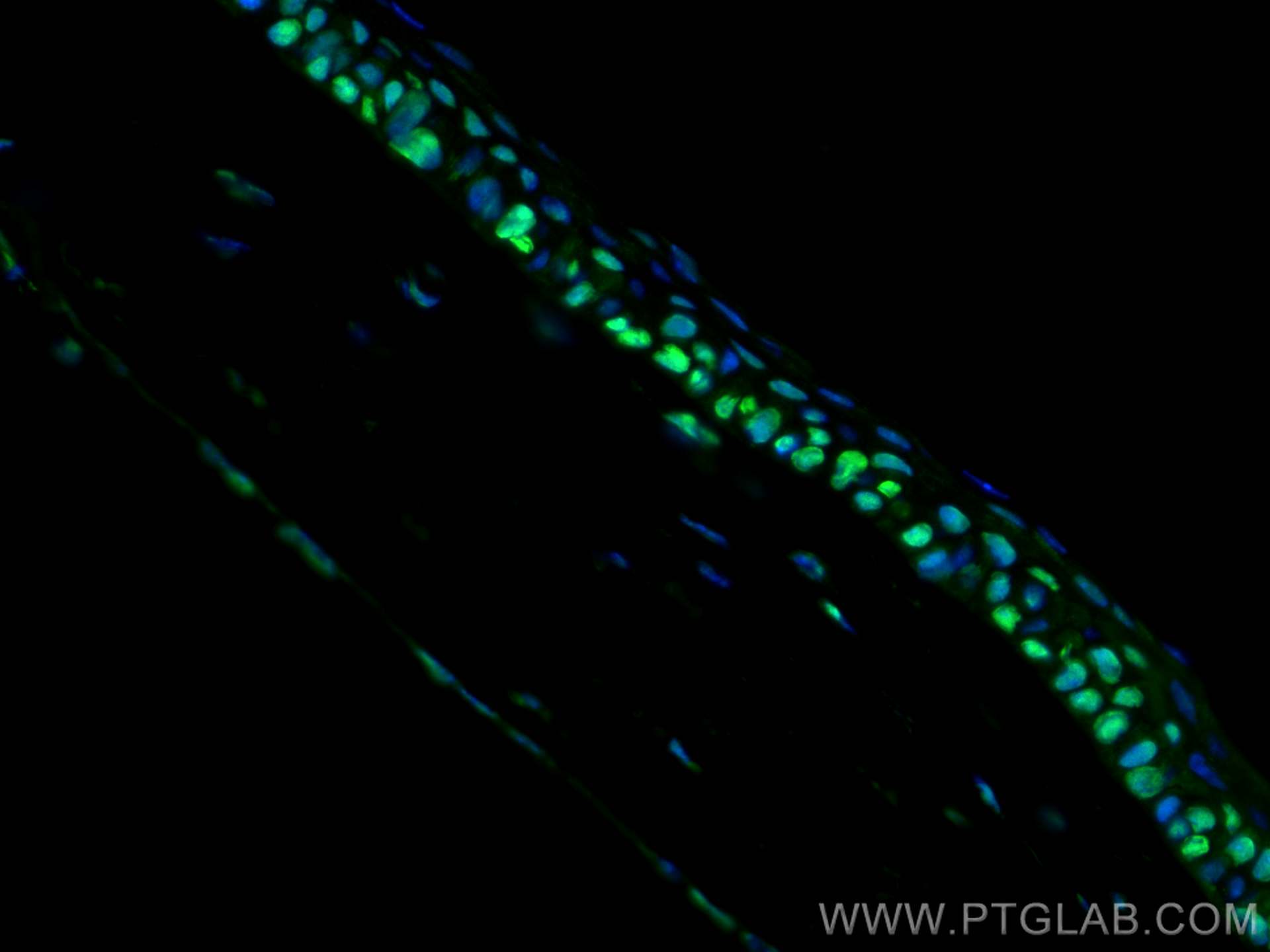 Immunofluorescence (IF) / fluorescent staining of mouse eye tissue using OCT4/POU5F1 Polyclonal antibody (11263-1-AP)