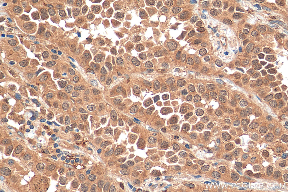 Oct4 Ihc OCT4/POU5F1 antibody (11263-1-AP) | Proteintech