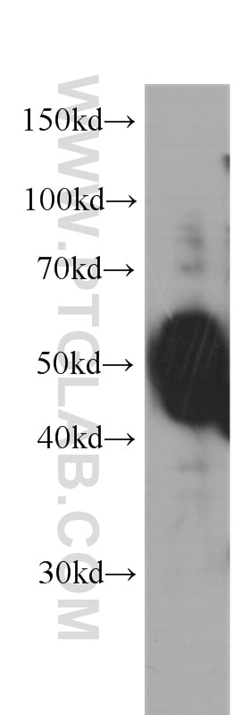 Western Blot (WB) analysis of human brain tissue using OCT4 Monoclonal antibody (60242-1-Ig)