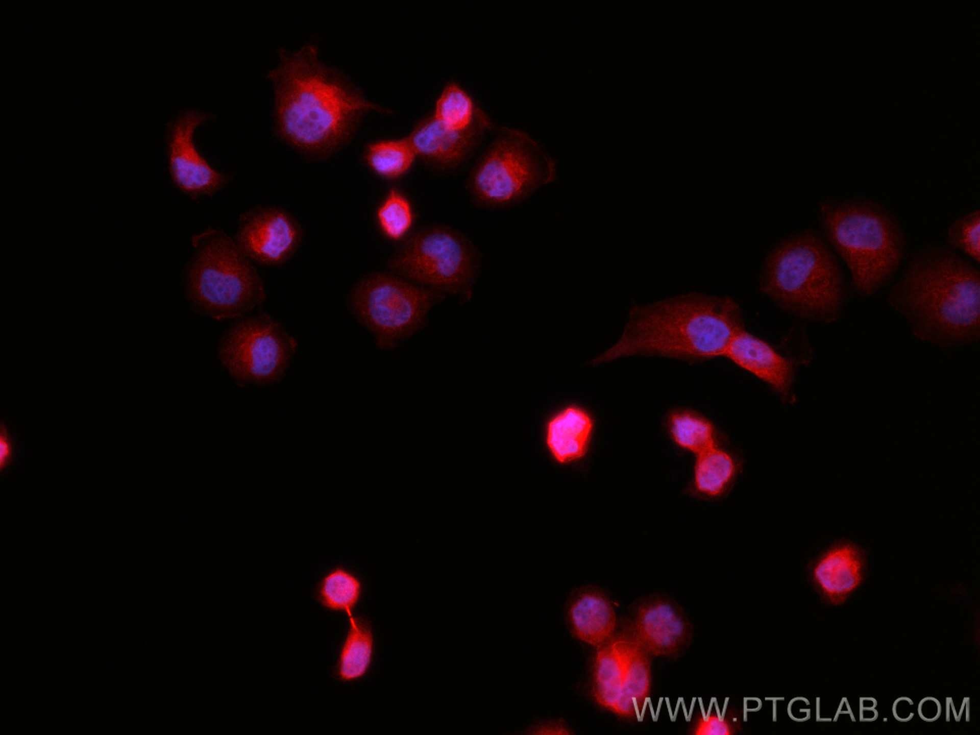 Immunofluorescence (IF) / fluorescent staining of NCCIT cells using CoraLite®594-conjugated OCT4 Polyclonal antibody (CL594-11263)