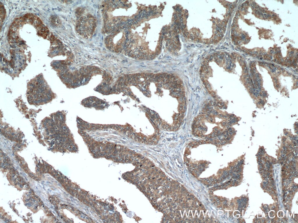 Immunohistochemistry (IHC) staining of human prostate hyperplasia tissue using ODC1 Polyclonal antibody (17003-1-AP)