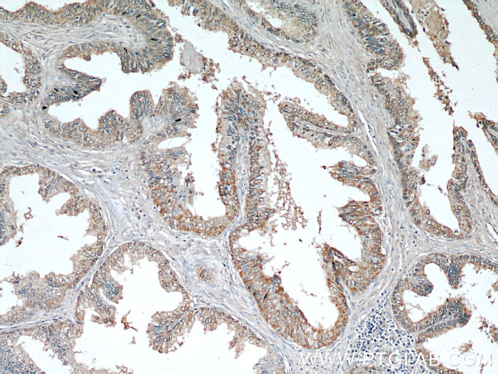 Immunohistochemistry (IHC) staining of human prostate hyperplasia tissue using ODC1 Polyclonal antibody (17003-1-AP)