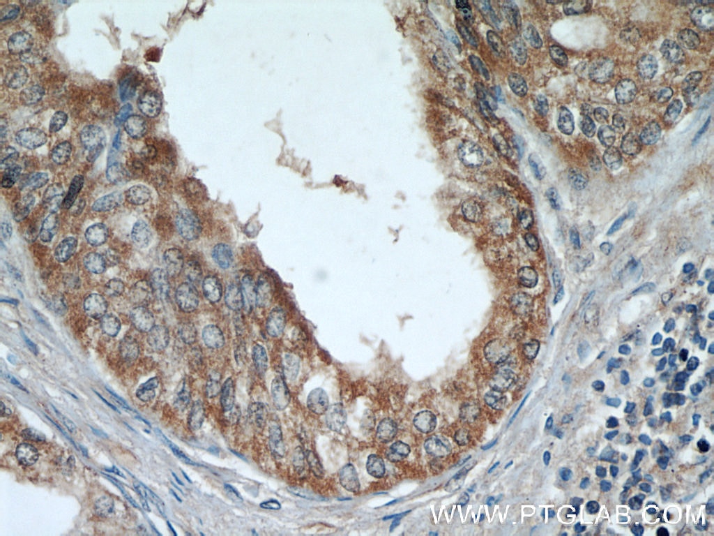 Immunohistochemistry (IHC) staining of human prostate hyperplasia tissue using ODC1 Polyclonal antibody (17003-1-AP)
