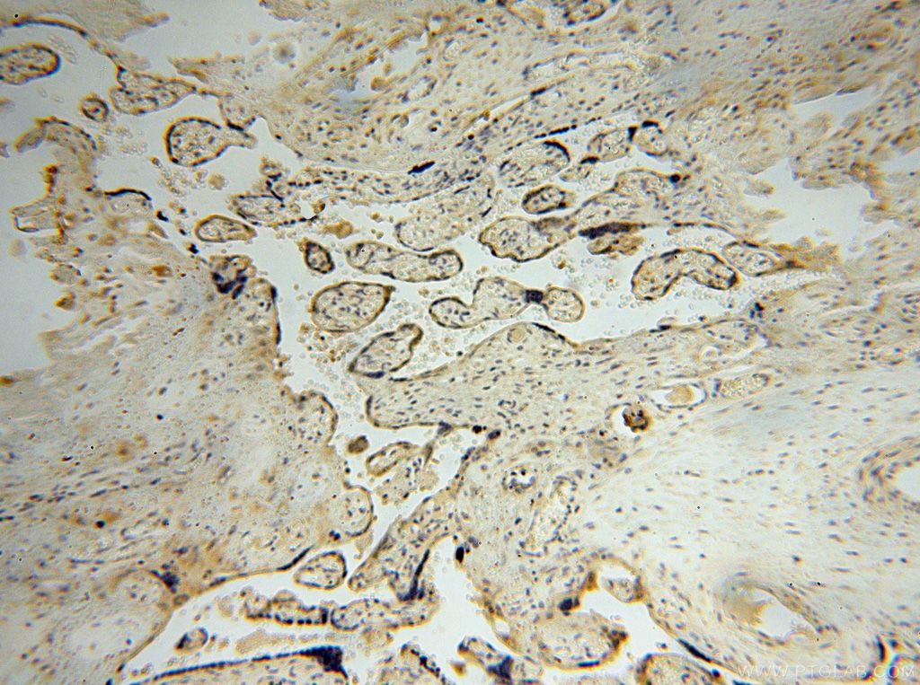 Immunohistochemistry (IHC) staining of human placenta tissue using ODC1 Polyclonal antibody (17003-1-AP)