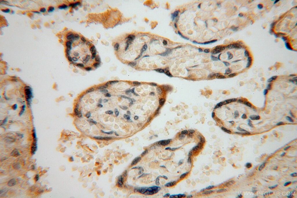 Immunohistochemistry (IHC) staining of human placenta tissue using ODC1 Polyclonal antibody (17003-1-AP)