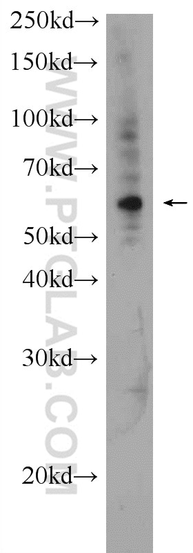 Western Blot (WB) analysis of mouse thymus tissue using ODC1 Polyclonal antibody (17003-1-AP)