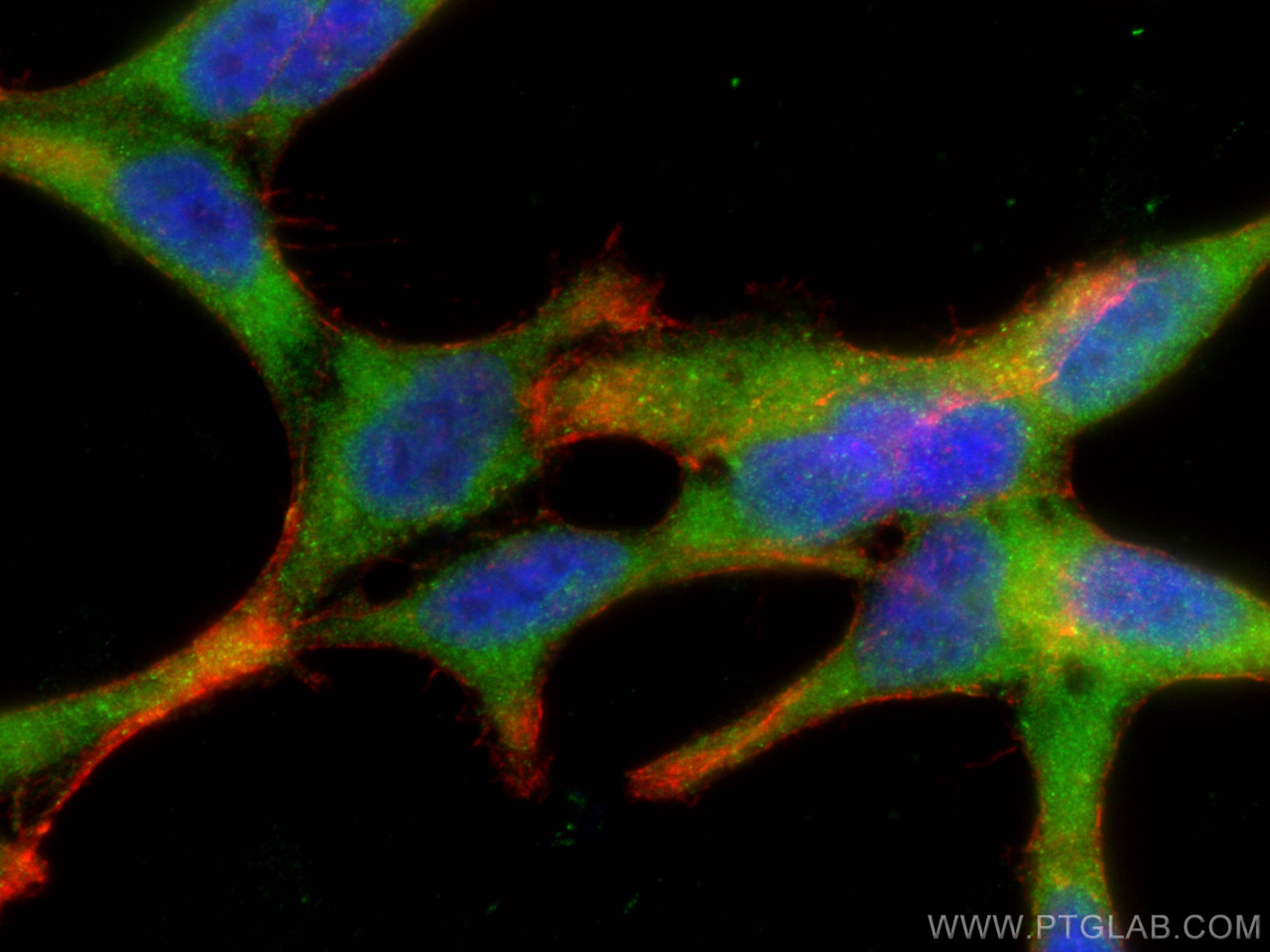 Immunofluorescence (IF) / fluorescent staining of LNCaP cells using ODC1 Polyclonal antibody (28728-1-AP)