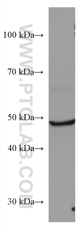 WB analysis of human placenta using 67336-1-Ig