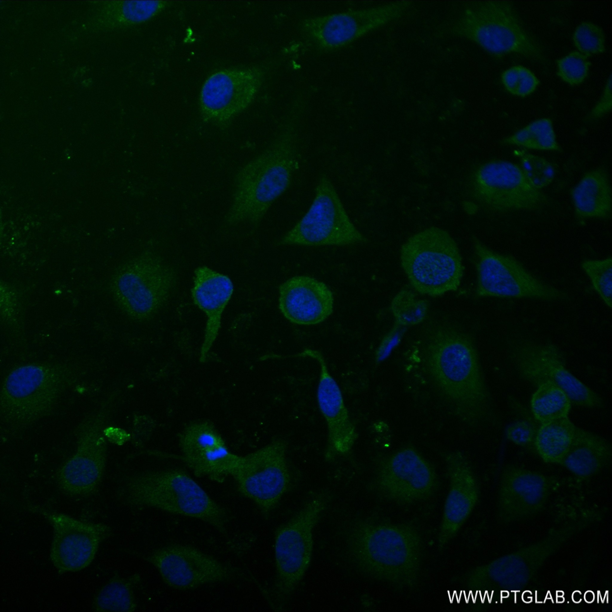 IF Staining of HeLa using 83108-1-RR