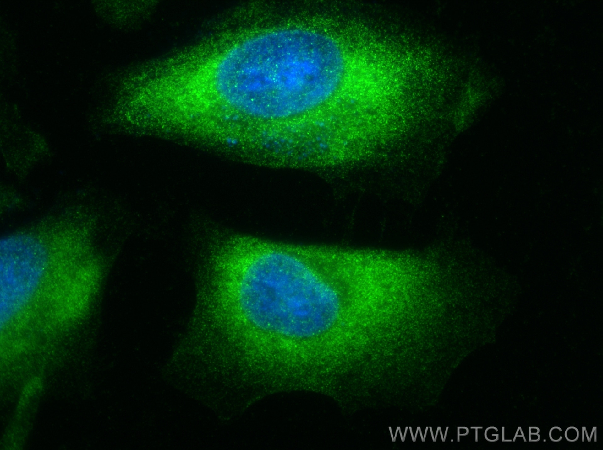Immunofluorescence (IF) / fluorescent staining of HeLa cells using ODC1 Recombinant antibody (83108-1-RR)