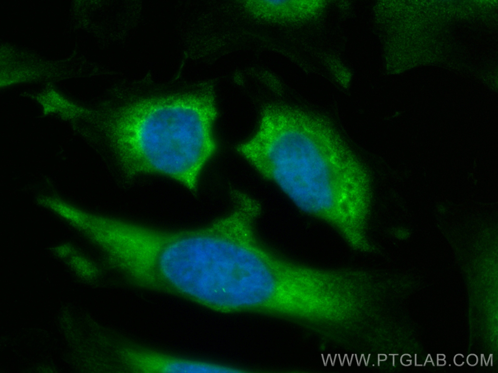 Immunofluorescence (IF) / fluorescent staining of HeLa cells using CoraLite® Plus 488-conjugated ODC1 Recombinant ant (CL488-83108)