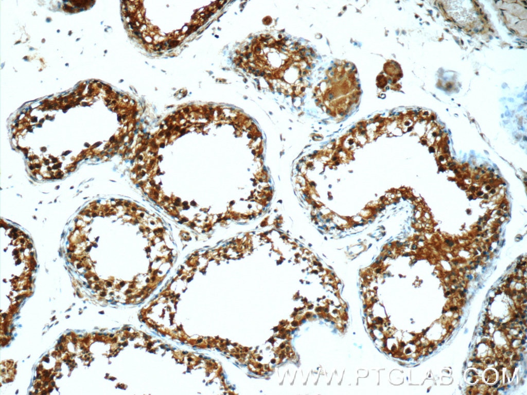 Immunohistochemistry (IHC) staining of human testis tissue using ODF1 Polyclonal antibody (24736-1-AP)