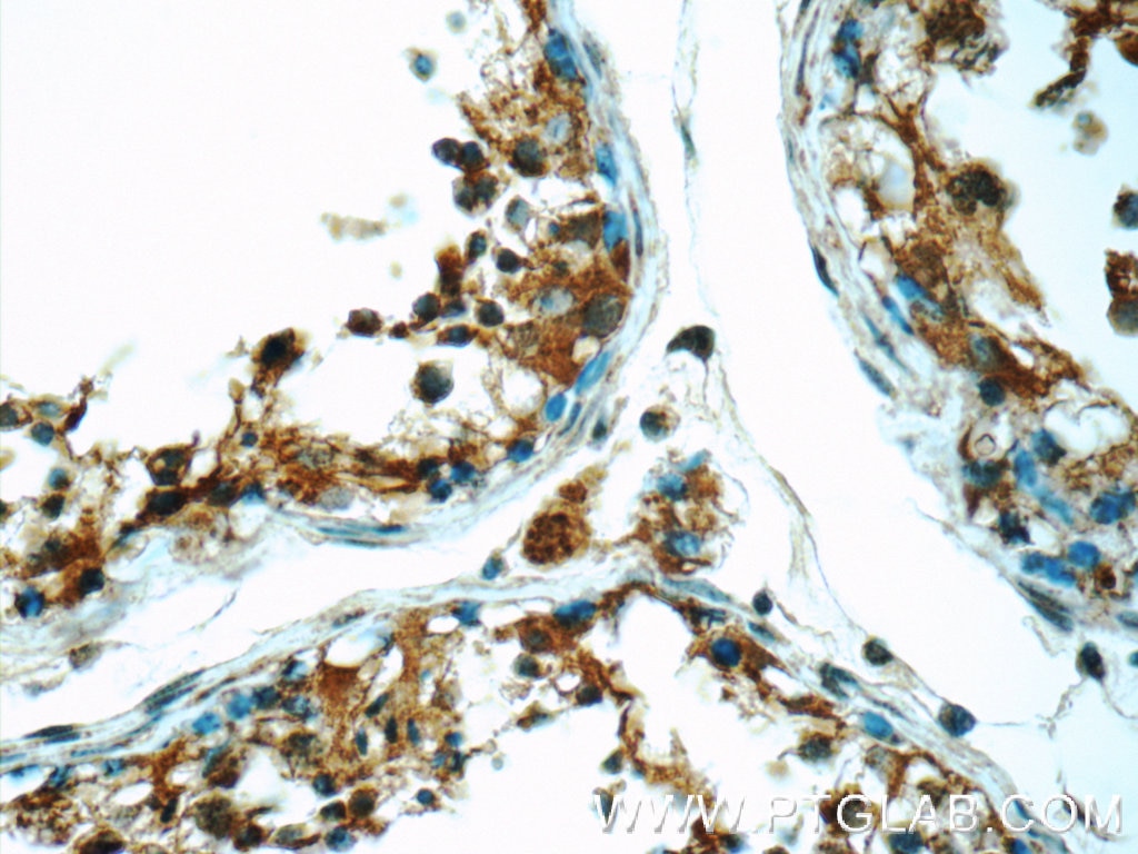 Immunohistochemistry (IHC) staining of human testis tissue using ODF1 Polyclonal antibody (24736-1-AP)