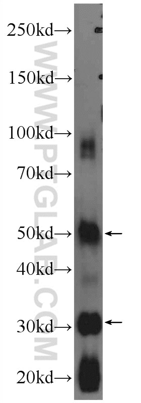 Western Blot (WB) analysis of rat testis tissue using ODF1 Polyclonal antibody (24736-1-AP)