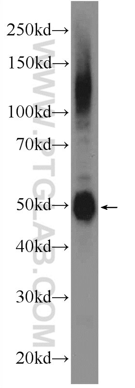 WB analysis of mouse testis using 24736-1-AP