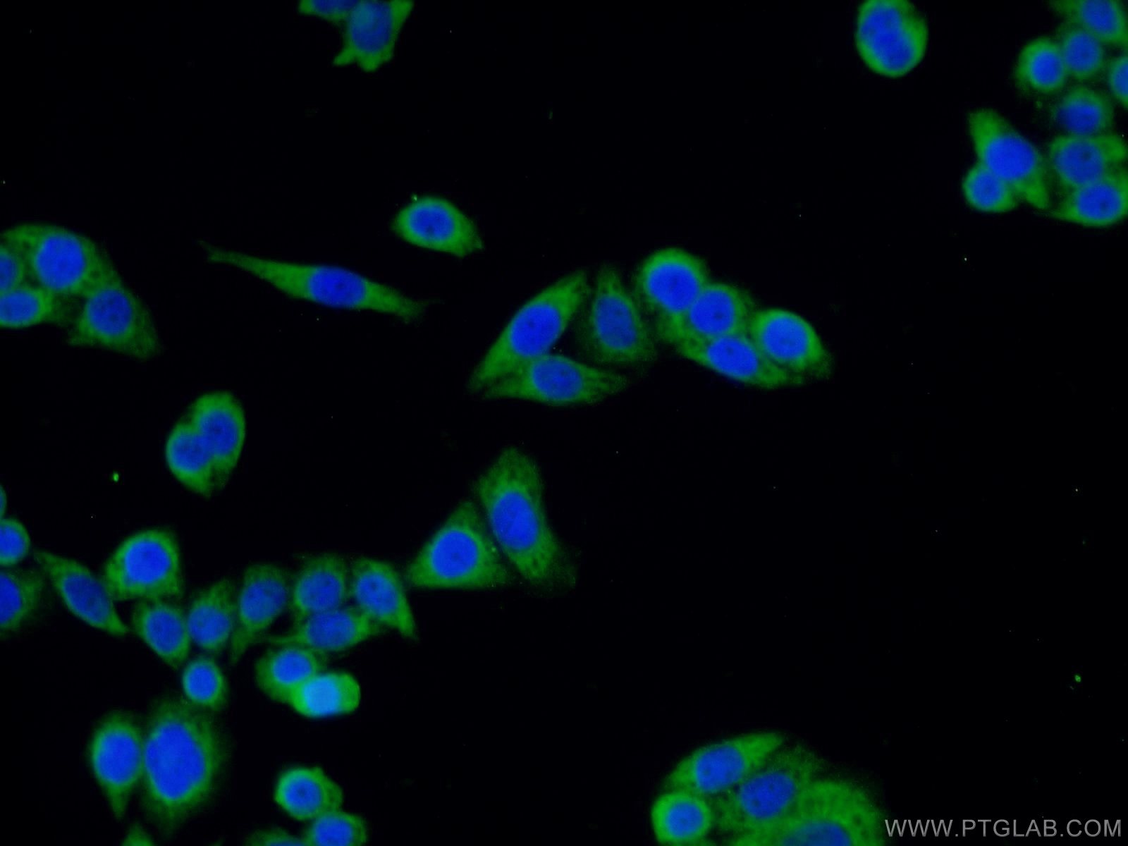 Immunofluorescence (IF) / fluorescent staining of HeLa cells using ODF2 Polyclonal antibody (12058-1-AP)