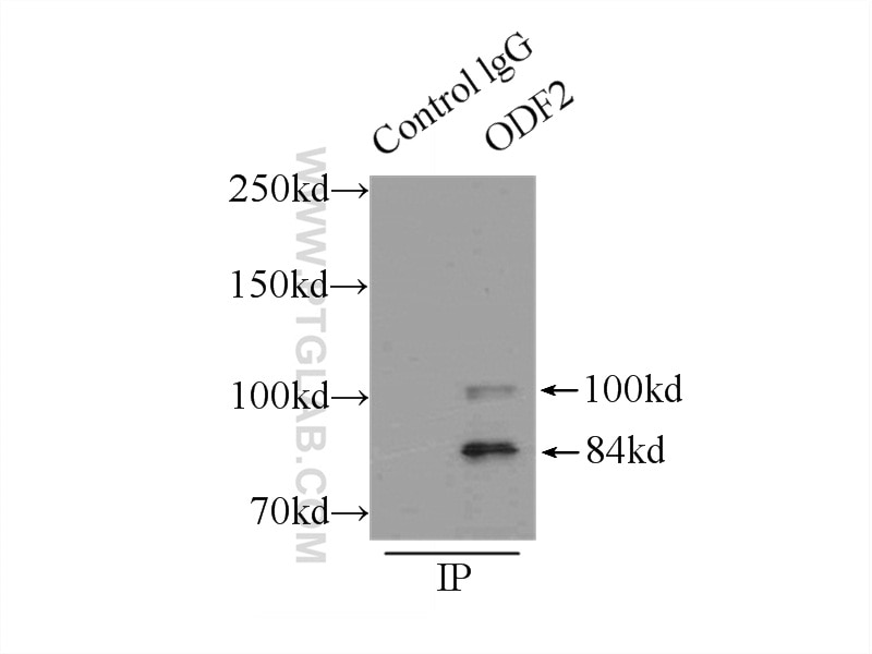 Immunoprecipitation (IP) experiment of mouse testis tissue using ODF2 Polyclonal antibody (12058-1-AP)