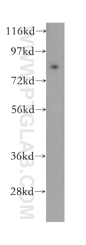 Western Blot (WB) analysis of mouse lung tissue using ODF2 Polyclonal antibody (12058-1-AP)