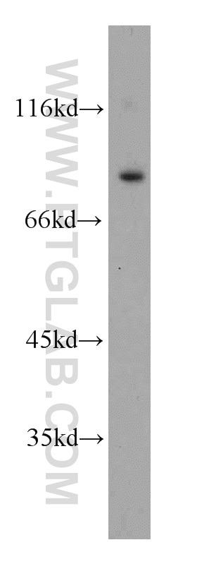 Western Blot (WB) analysis of mouse testis tissue using ODF2 Polyclonal antibody (12058-1-AP)