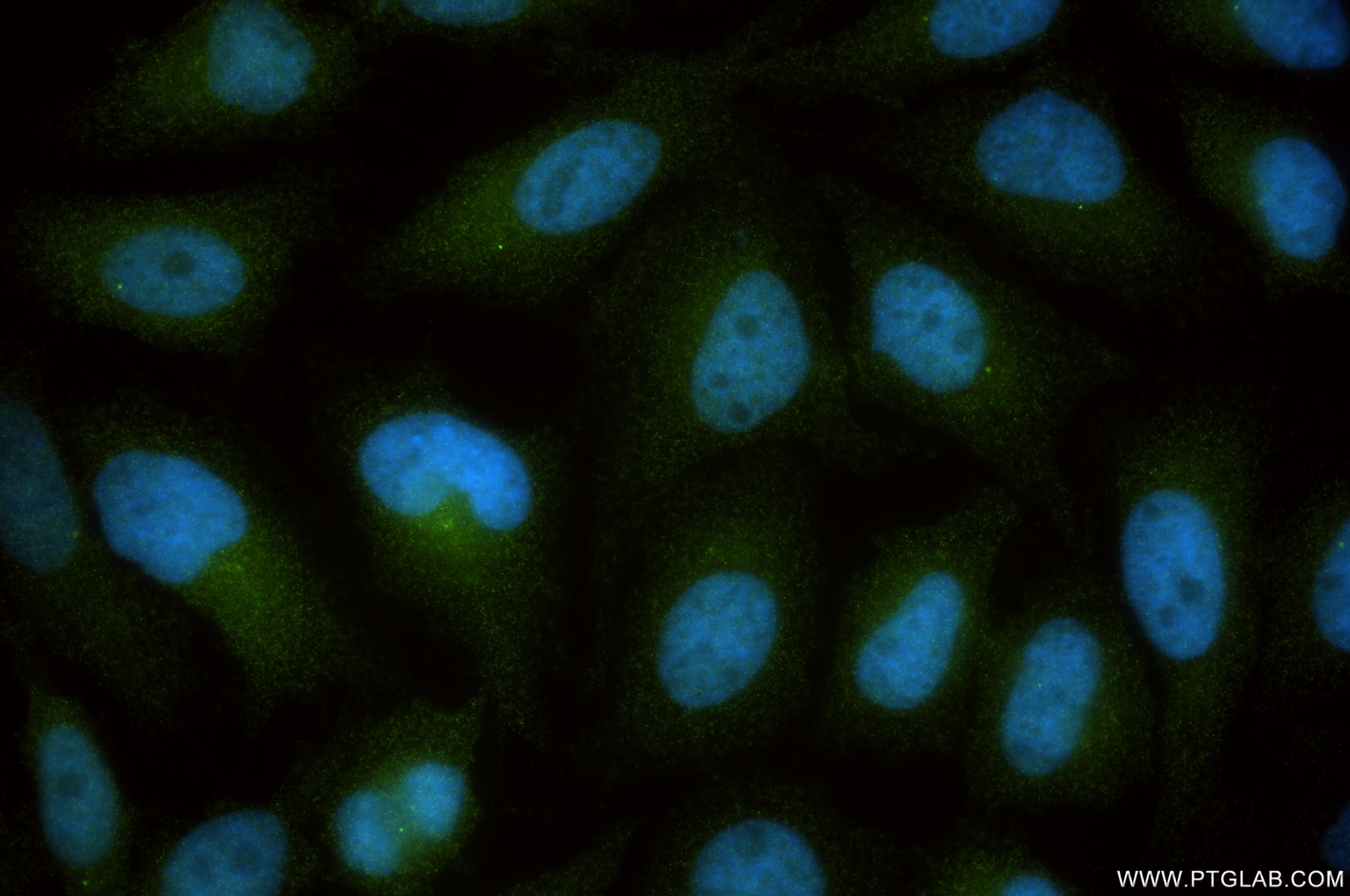 Immunofluorescence (IF) / fluorescent staining of HeLa cells using ODF2 Recombinant monoclonal antibody (86459-2-RR)