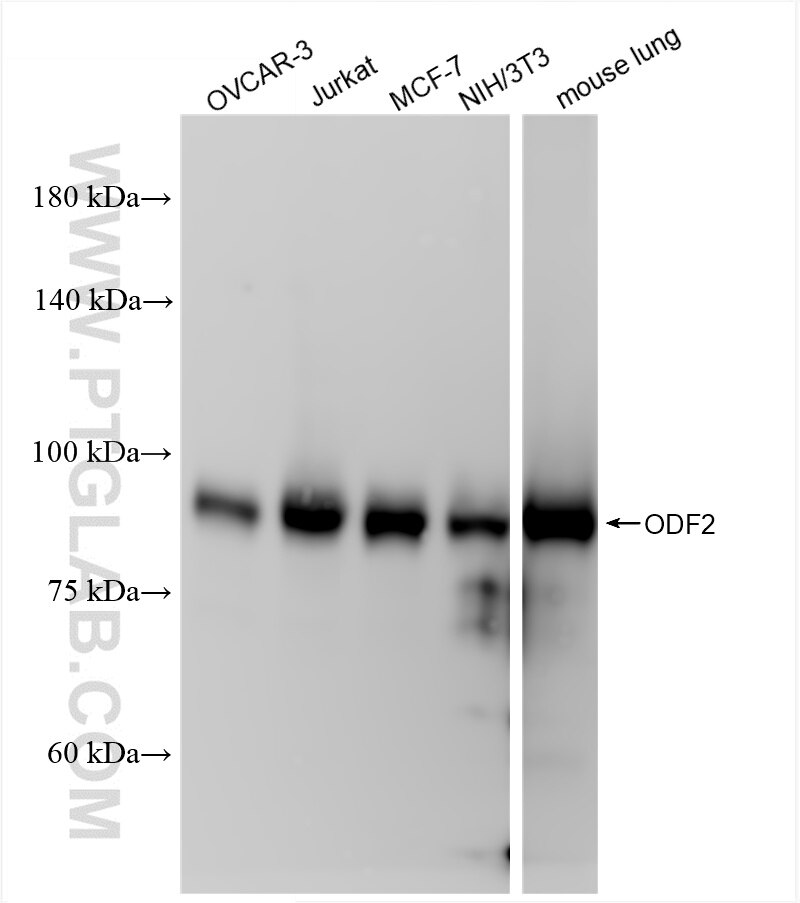 Various lysates were subjected to SDS PAGE followed by western blot with 86459-2-RR (ODF2 antibody) at dilution of 1:10000 incubated at room temperature for 1.5 hours. Western Blot (WB) analysis of various lysates using ODF2 Recombinant antibody (86459-2-RR)