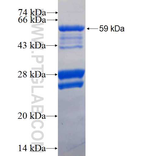 ODF2 fusion protein Ag2693 SDS-PAGE