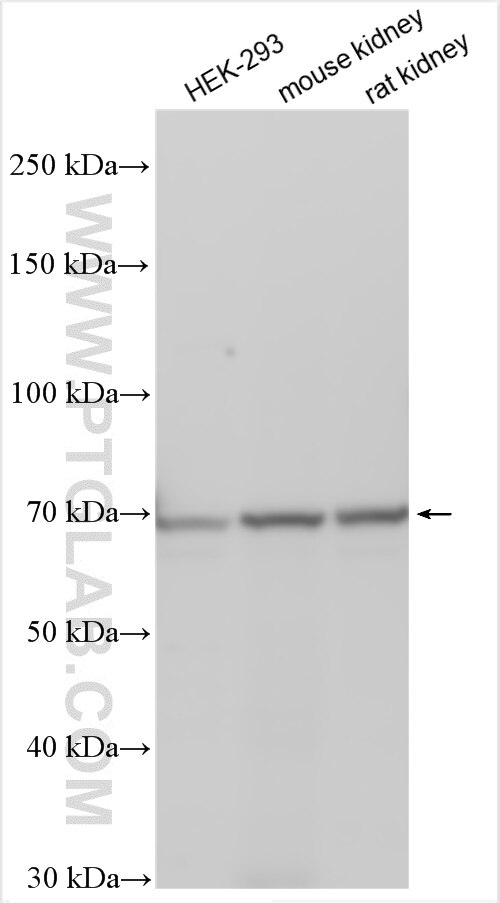 Western Blot (WB) analysis of various lysates using ODF2L Polyclonal antibody (23887-1-AP)