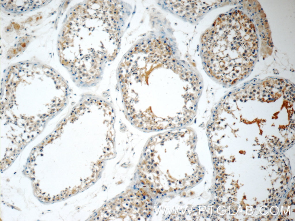 Immunohistochemistry (IHC) staining of human testis tissue using ODF3 Polyclonal antibody (25097-1-AP)