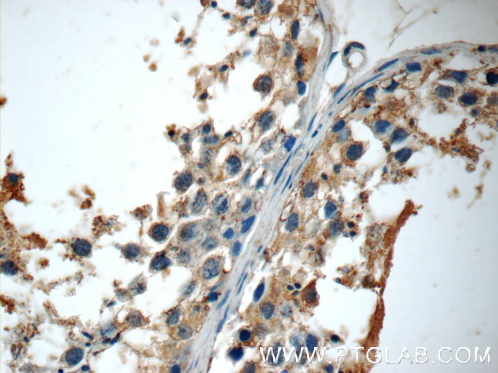 IHC staining of human testis using 25097-1-AP