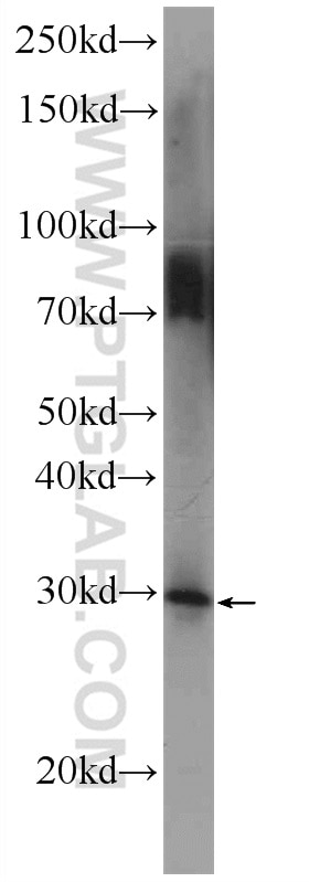 Western Blot (WB) analysis of rat testis tissue using ODF3 Polyclonal antibody (25097-1-AP)