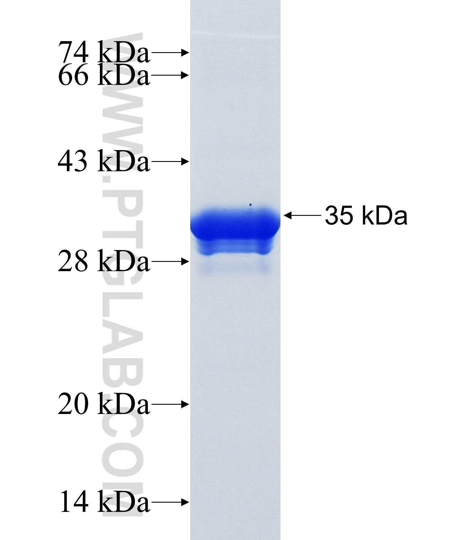 ODF4 fusion protein Ag36966 SDS-PAGE ODF4 fusion protein Ag36966 SDS-PAGE