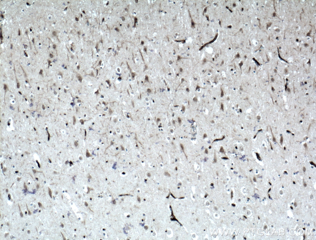 Immunohistochemistry (IHC) staining of human brain tissue using Teneurin 1 Polyclonal antibody (21696-1-AP)